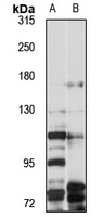 Anti-BetaKlotho Antibody