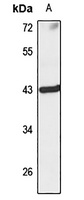 Anti-KLHDC3 Antibody