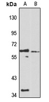 KLHL13 antibody