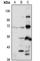 Anti-KLHL41 Antibody