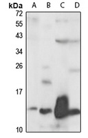 Anti-KLRC4 Antibody