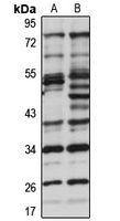Anti-KNSTRN Antibody