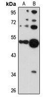 Anti-Cytokeratin 36 Antibody