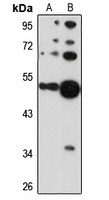 Cytokeratin 36 antibody