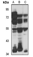 Anti-LARP6 Antibody