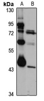 LAX1 antibody