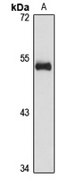 Anti-NOL55 Antibody