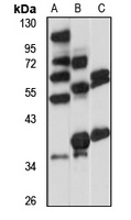 Anti-Galectin 4 Antibody