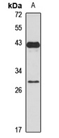 Anti-LIN28B Antibody