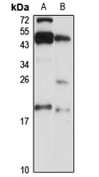 Anti-LLPH Antibody