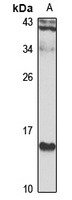 Anti-LMO1 Antibody