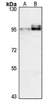 Anti-LOXL2 Antibody