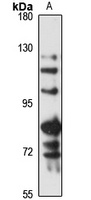 Anti-LOXL4 Antibody