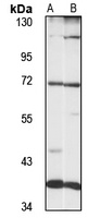LRRFIP1 antibody
