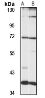 Anti-LRRFIP1 Antibody