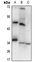 Anti-LSAMP Antibody