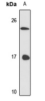 LSm3 antibody