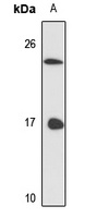Anti-LSm3 Antibody