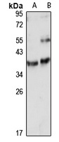 LYPD3 antibody