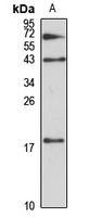 Anti-MAFF Antibody