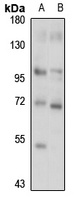 MAN1A1 antibody
