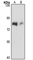 Anti-MAN1A2 Antibody