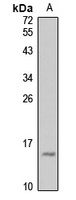 ARMET antibody