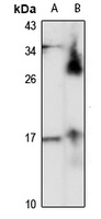 LC3C antibody