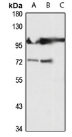 Anti-GCK Antibody