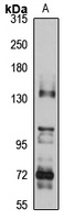 Anti-NGK Antibody