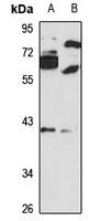 Anti-MBNL2 Antibody