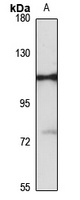 Anti-DBL Antibody