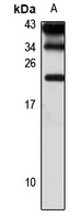 Anti-MCTS1 Antibody