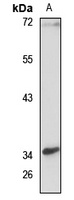 Anti-CCDC109A Antibody