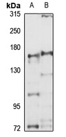 Anti-MED14 Antibody