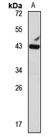 Anti-MEF2B Antibody