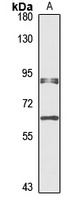 METTL13 antibody