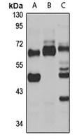 Anti-METTL14 Antibody