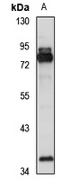 Anti-METTL16 Antibody
