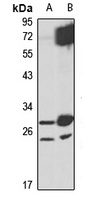 METTL7B antibody