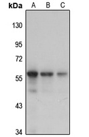 GnT-IVa antibody