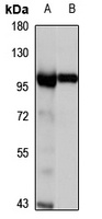 Anti-MGAT5 Antibody