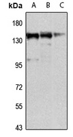 Anti-MKL1 Antibody