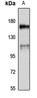 Anti-MKL1 Antibody
