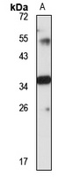 Anti-MLKL Antibody