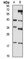 MMADHC antibody