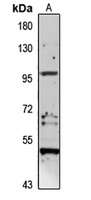 Anti-NEP2 Antibody