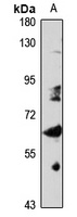 Anti-MON1B Antibody