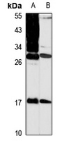 Anti-MPZL1 Antibody