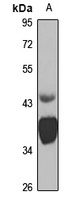 MR1 antibody